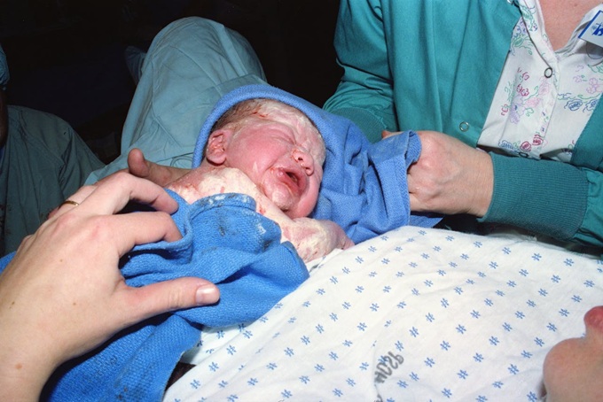 Birth injuries (Tom Fisk Pexels)